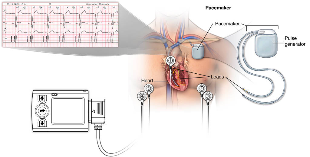 iTengo+動(dòng)態(tài)心電圖記錄器,動(dòng)態(tài)心電記錄器,動(dòng)態(tài)心電記錄儀,動(dòng)態(tài)心電圖,動(dòng)態(tài)心電圖記錄儀,12導(dǎo)動(dòng)態(tài)心電圖機(jī),24小時(shí)動(dòng)態(tài)心電圖檢測(cè),動(dòng)態(tài)心電檢測(cè)儀,心電監(jiān)護(hù)儀,動(dòng)態(tài)心電圖工作站,遠(yuǎn)程心電網(wǎng)絡(luò),博聲醫(yī)療,博聲醫(yī)械