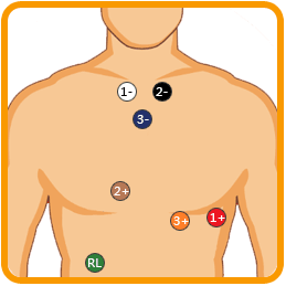 iTengo+動(dòng)態(tài)心電圖記錄器,動(dòng)態(tài)心電記錄器,動(dòng)態(tài)心電記錄儀,動(dòng)態(tài)心電圖,動(dòng)態(tài)心電圖記錄儀,12導(dǎo)動(dòng)態(tài)心電圖機(jī),24小時(shí)動(dòng)態(tài)心電圖檢測(cè),動(dòng)態(tài)心電檢測(cè)儀,心電監(jiān)護(hù)儀,動(dòng)態(tài)心電圖工作站,遠(yuǎn)程心電網(wǎng)絡(luò),博聲醫(yī)療,博聲醫(yī)械