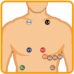 iTengo+動(dòng)態(tài)心電圖記錄器,動(dòng)態(tài)心電記錄器,動(dòng)態(tài)心電記錄儀,動(dòng)態(tài)心電圖,動(dòng)態(tài)心電圖記錄儀,12導(dǎo)動(dòng)態(tài)心電圖機(jī),24小時(shí)動(dòng)態(tài)心電圖檢測(cè),動(dòng)態(tài)心電檢測(cè)儀,心電監(jiān)護(hù)儀,動(dòng)態(tài)心電圖工作站,遠(yuǎn)程心電網(wǎng)絡(luò),博聲醫(yī)療,博聲醫(yī)械