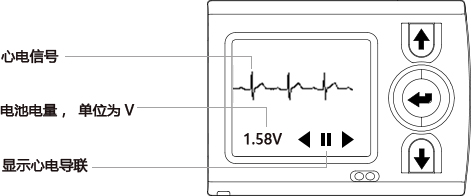 iTengo+動(dòng)態(tài)心電圖記錄器,動(dòng)態(tài)心電記錄器,動(dòng)態(tài)心電記錄儀,動(dòng)態(tài)心電圖,動(dòng)態(tài)心電圖記錄儀,12導(dǎo)動(dòng)態(tài)心電圖機(jī),24小時(shí)動(dòng)態(tài)心電圖檢測(cè),動(dòng)態(tài)心電檢測(cè)儀,心電監(jiān)護(hù)儀,動(dòng)態(tài)心電圖工作站,遠(yuǎn)程心電網(wǎng)絡(luò),博聲醫(yī)療,博聲醫(yī)械