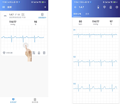博聲醫(yī)療,動(dòng)態(tài)心電血壓二合一,動(dòng)態(tài)心電血壓工作站,動(dòng)態(tài)心電血壓遙測(cè)二合一,心電血壓二合一監(jiān)護(hù)儀,動(dòng)態(tài)心電血壓監(jiān)測(cè)儀,動(dòng)態(tài)心電血壓監(jiān)護(hù)儀,動(dòng)態(tài)心電二合一,心電血壓遙測(cè)二合一,心電血壓監(jiān)測(cè)儀,博聲醫(yī)械