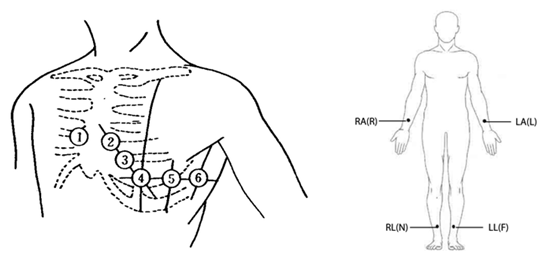 博聲醫(yī)療,博聲醫(yī)械,ECG,心電圖儀,心電圖機,醫(yī)院心電圖機,12導心電圖機,常規(guī)心電圖,靜態(tài)心電圖,動態(tài)心電圖,心電檢測,心電圖機工作站