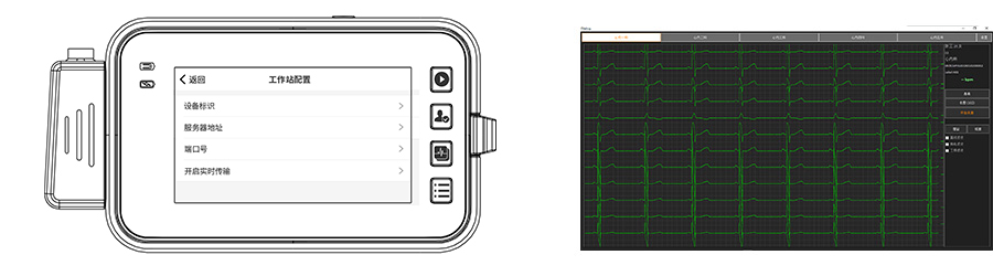 博聲醫(yī)療,博聲醫(yī)械,ECG,心電圖儀,心電圖機,醫(yī)院心電圖機,12導心電圖機,常規(guī)心電圖,靜態(tài)心電圖,動態(tài)心電圖,心電檢測,心電圖機工作站