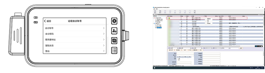 博聲醫(yī)療,博聲醫(yī)械,ECG,心電圖儀,心電圖機,醫(yī)院心電圖機,12導心電圖機,常規(guī)心電圖,靜態(tài)心電圖,動態(tài)心電圖,心電檢測,心電圖機工作站